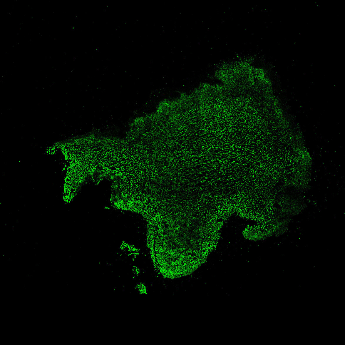 Human foetal midbrain